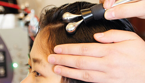 改善脫發(fā)及頭皮問題問題